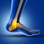 foot joint pain